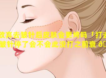 放弃去皱针后皮肤会更垮吗「打去皱针停了会不会此没打之前衰 💐 老快」